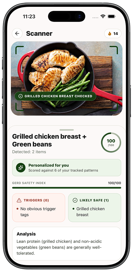 GERDBuddy food scanner showing a meal analysis